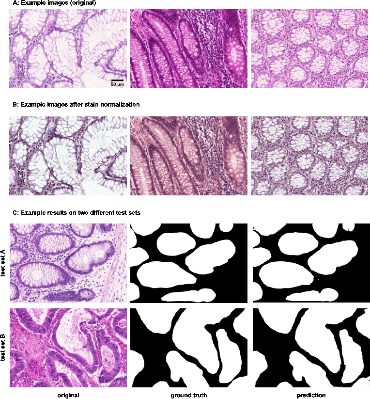 Figure 4: Example results of 2D semantic segmentation of gland in H&E images. A and B provide insight into the stain normalization implemented in MMV_Im2Im. C compares a raw example image before stain normalization and prediction to the ground truth for each test set.