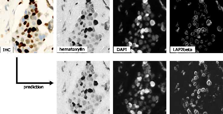 Figure 12: Qualitative visualization of staining transformation results with the MMV_Im2Im package. The top row refers to the input image (IHC) and to the respective ground truth for hematoxylin, DAPI and LAP2beta, while the bottom row shows the respective prediction.