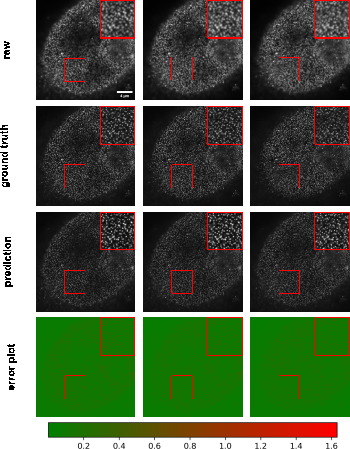 Figure 11: Example results of confocal-to-STED modality transformation nuclear pore in three consecutive z-slices. From top to bottom: raw confocal images, reference STED images, predicted images, error plots. For the error plots, the ground truth images were normalized as described in the main text. The contrast of grayscale images was adjusted using ImageJ’s autoscale.