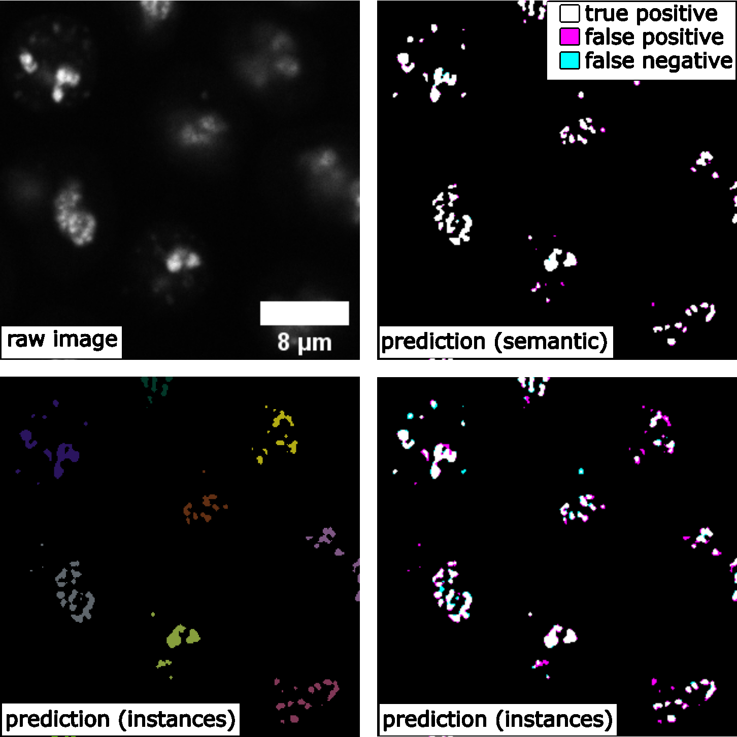 Figure 6: Comparing 3D semantic segmentation and 3D instance segmentation results on confocal microscopy images of fibrillarin (showing a middle Z-slice of a 3D stack). Shown are the raw image, the prediction of the instance segmentation, and for both segmentations a mask that gives an overview of true positive, false negative, and false positive pixels.