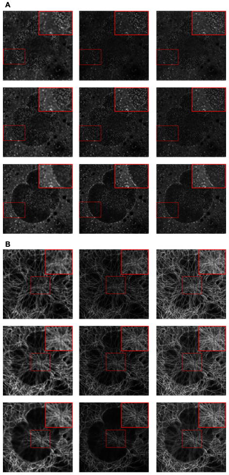 Figure 9: Example results of confocal-to-STED modality transformation of nuclear pore (A) and microtubule (B) in three consecutive z-slices. From left to right: raw confocal images, reference STED images, predicted images.