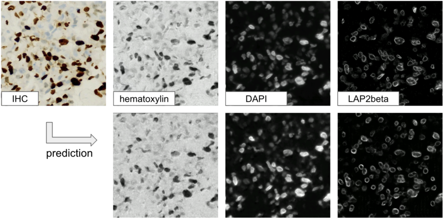 Figure 10: Qualitative visualization of staining transformation results with the MMV_Im2Im package.