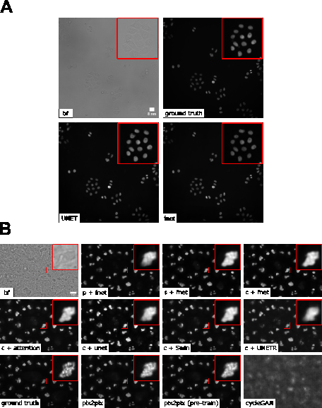Figure 2: A. Example of 2D labelfree results. B. Overview of various 3D labelfree results obtained by different training strategies. p/c/s refers to percentile normalization, center normalization, and standard normalization, respectively (see main text for details). (The contrast of grayscale images was adjusted using ImageJ’s autoscale.)