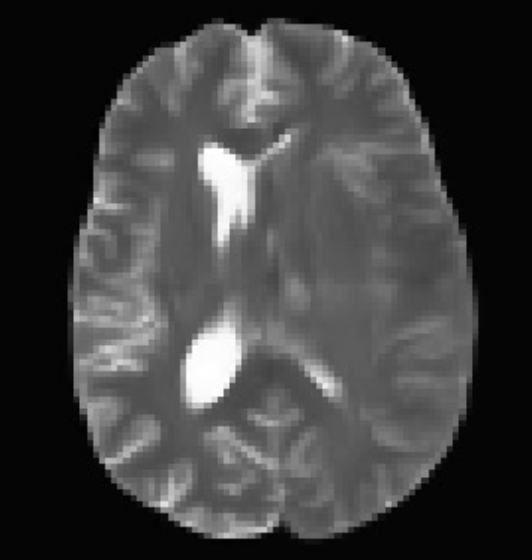 Rethinking Medical Anomaly Detection in Brain MRI: An Image Quality Assessment Perspective