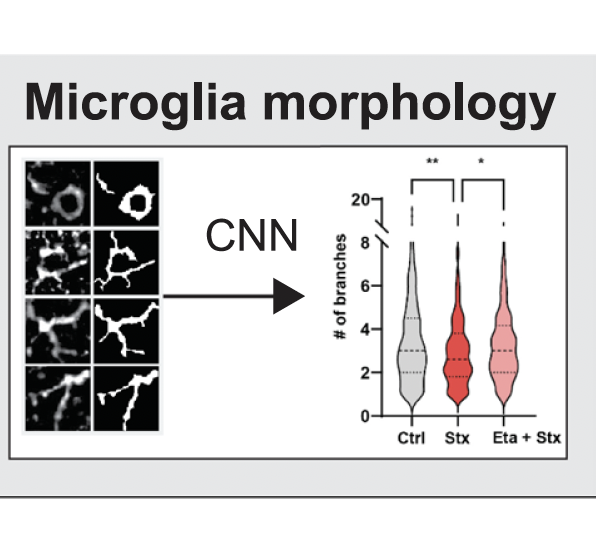 Inhibition of tumour necrosis factor alpha by Etanercept attenuates Shiga toxin-induced brain pathology