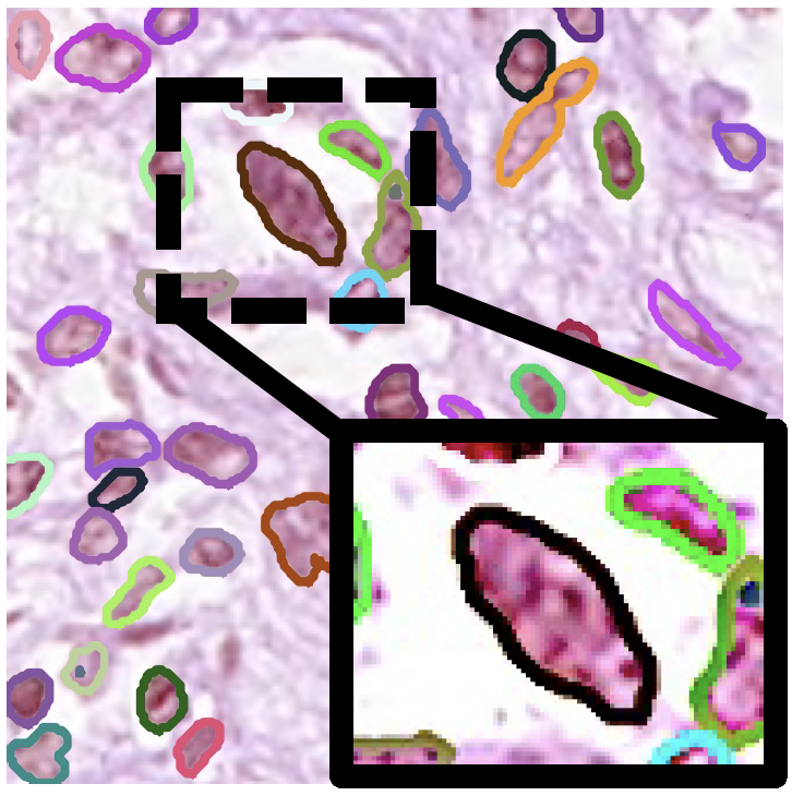 Category Prompt Mamba Network for Nuclei Segmentation and Classification